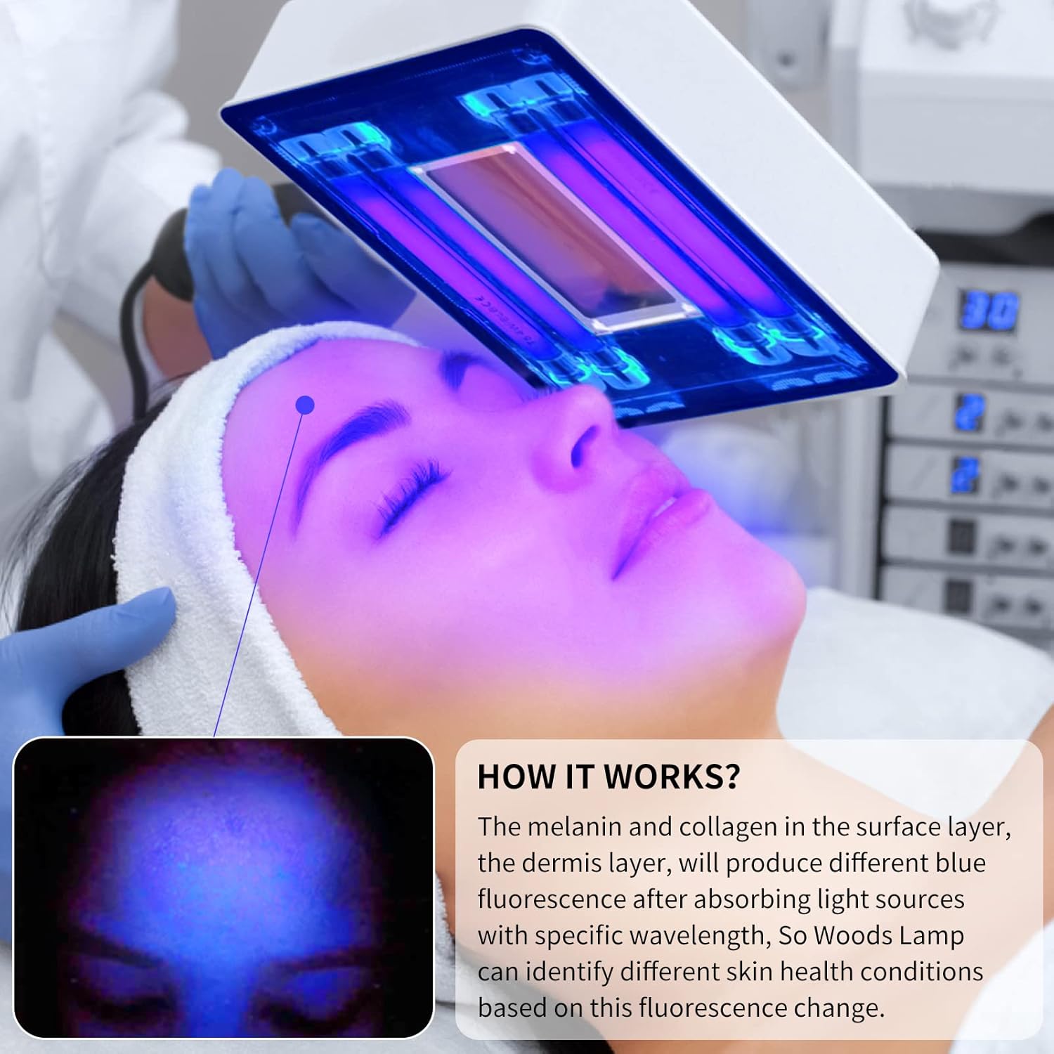 Woods Lamp Skin Analyzer,Magni - огляд і ціна Lighting Jockey